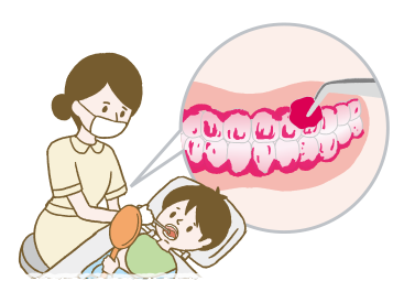 PCRの確認