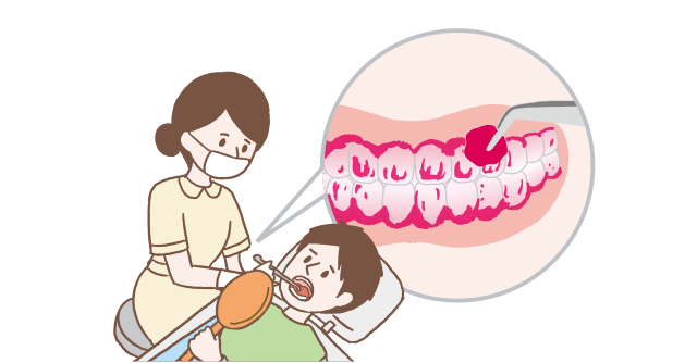 PCRの確認